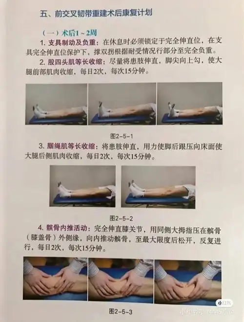 前交叉韧带重建术后康复方法