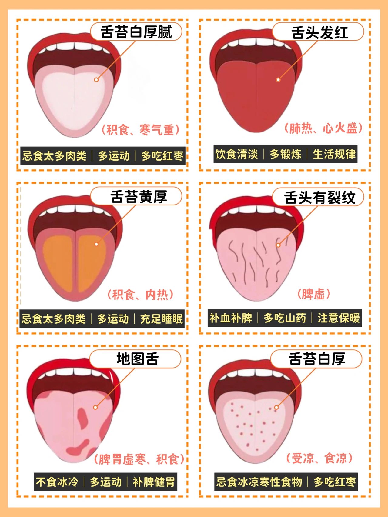 看看宝宝的舌头,如果是这种症状就要留意啦 宝宝的舌