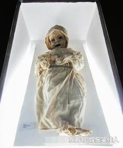 怀孕46年 八旬老妇产下"木乃伊"