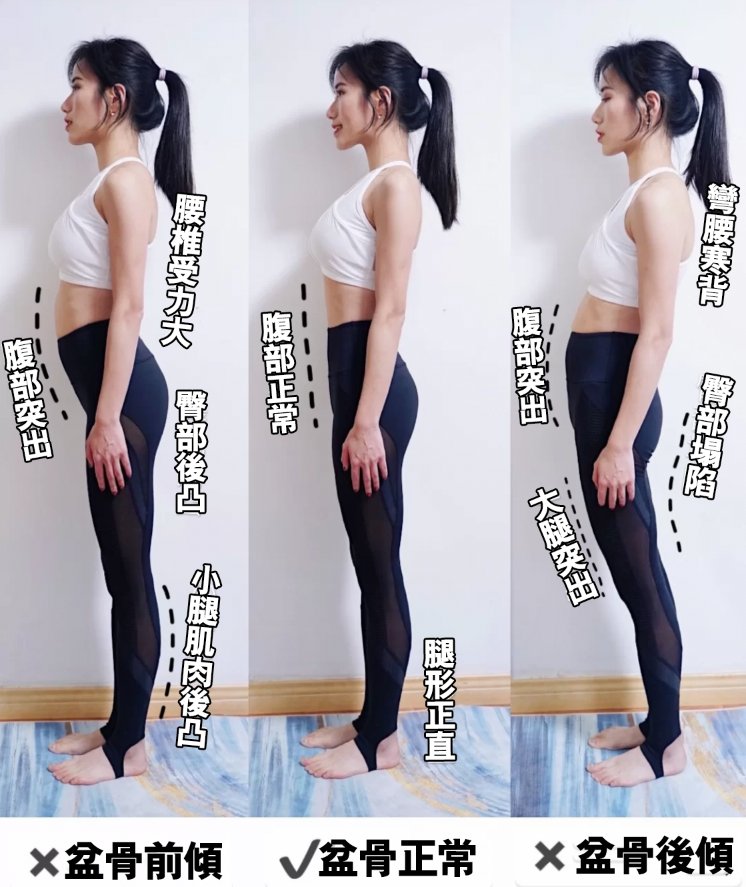 5个盆骨前倾矫正动作 改善腰痛,肚腩及大腿突出体态问题 | 运动瘦身 |