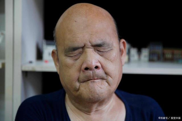 面瘫的前兆有哪些?面瘫该如何治疗?