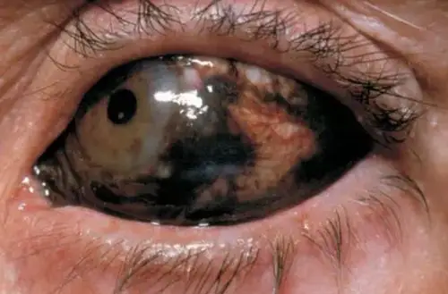 微博上刷到的漂亮眼睛 太好看了不能只让我一个人看见