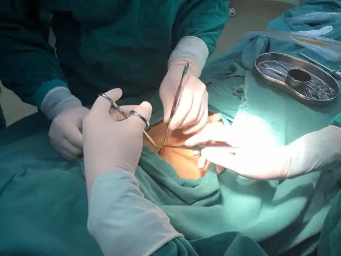 我院外科腹腔镜下腹股沟疝囊高位结扎术