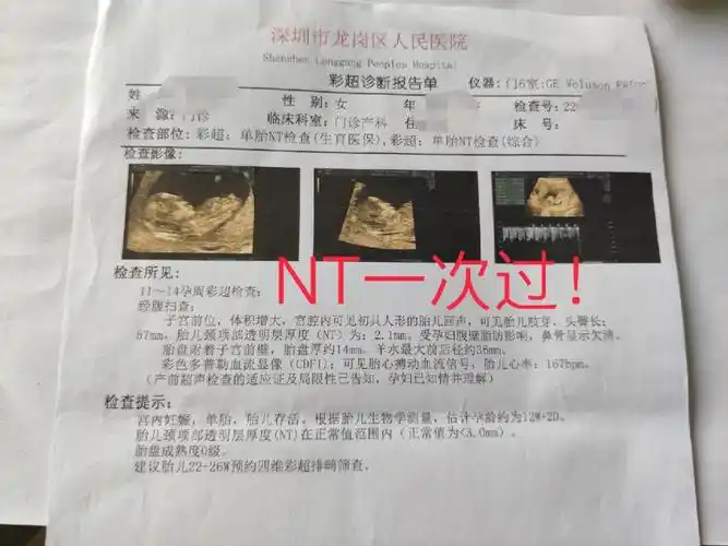 nt一次过,超全流程及注意事项