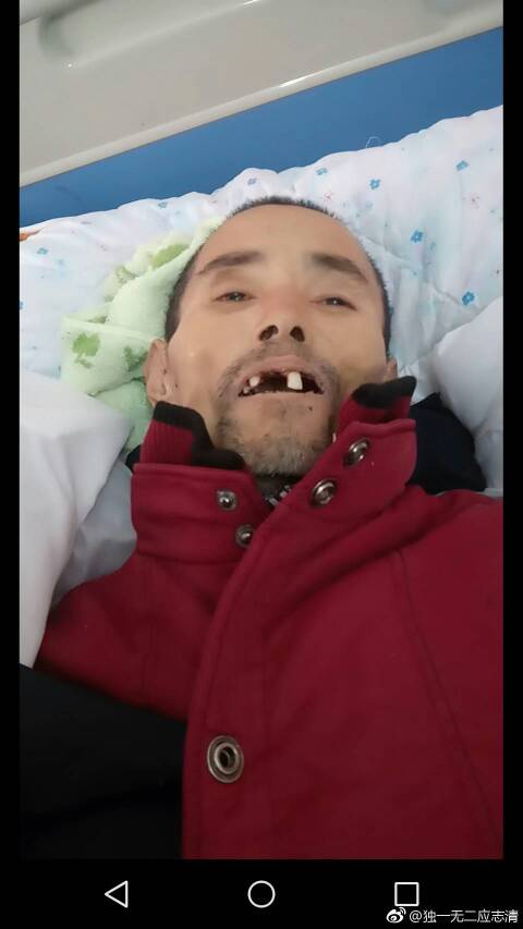 眼睛睁着像在哭,瞳孔没散,请问是不是弄错了呀,没死的人被人诊断死亡