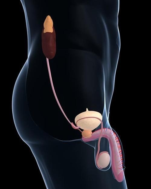 精索曲张睾丸下坠时图片 (9)