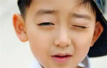 眯眼看东西,近视会加深吗?