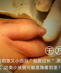 省儿保黄勇主任预约挂号