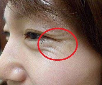 鱼尾纹多的女人真的克夫吗有一种鱼尾纹男人有财女人有福