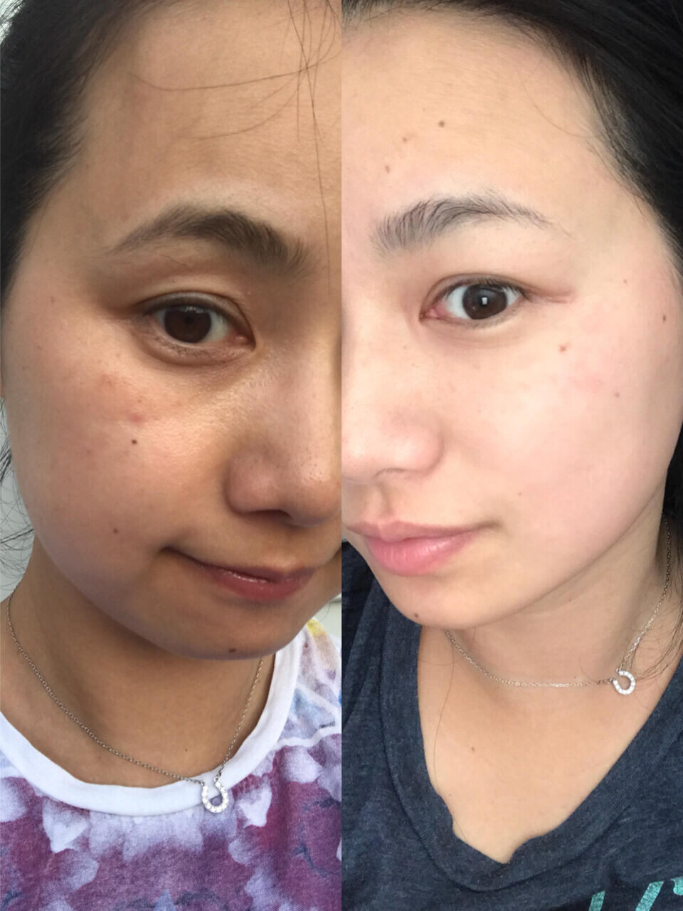 我的美白历程,自报家门,奔四的老阿姨,皮肤中性偏干 是不是很吓人的