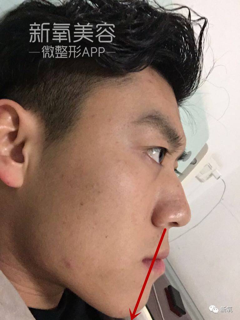 从地包天到花美男是做了什么