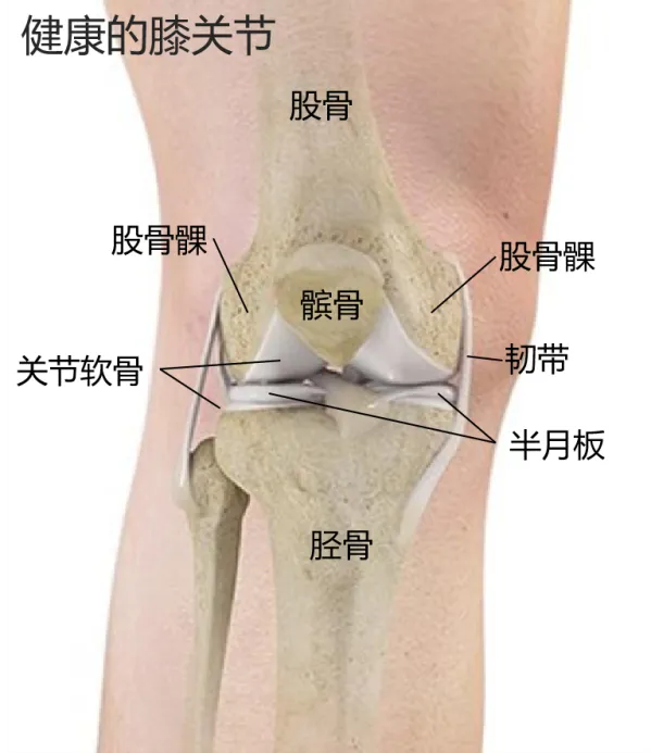 换了人工关节啥感觉?一文了解