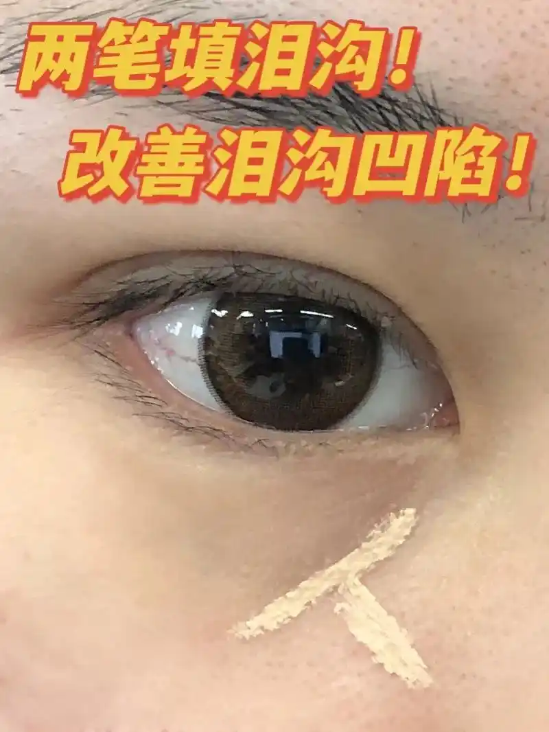 两笔提亮泪沟 改善泪沟凹陷  我是用这个遮瑕盘里的最浅色 象 - 抖音