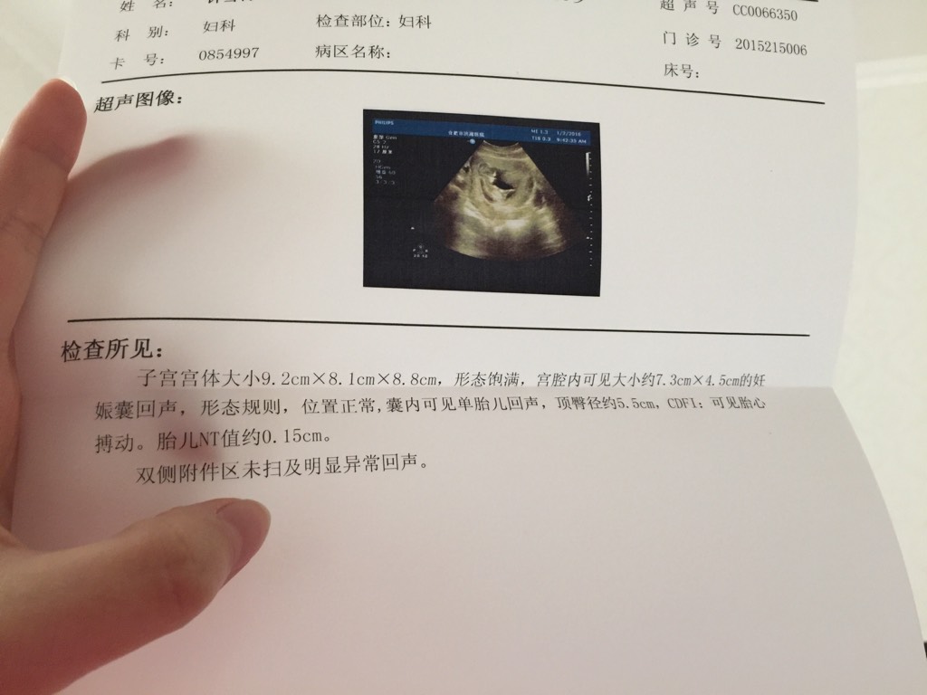 学会了看孕囊看男宝女宝,提供数据就行.