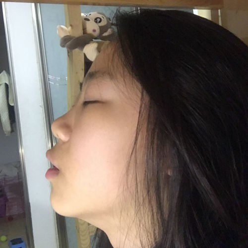 侧脸太丑了怎么办啊,怎么改善?