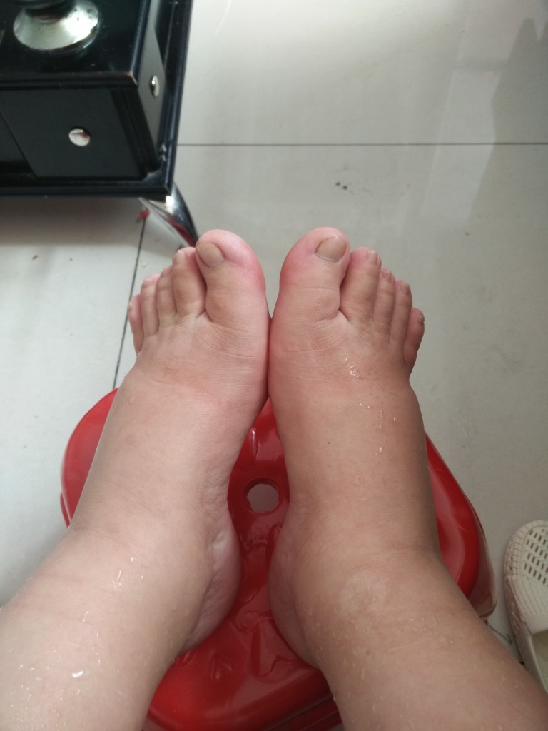 看看我肥胖的脚丫子只看楼主