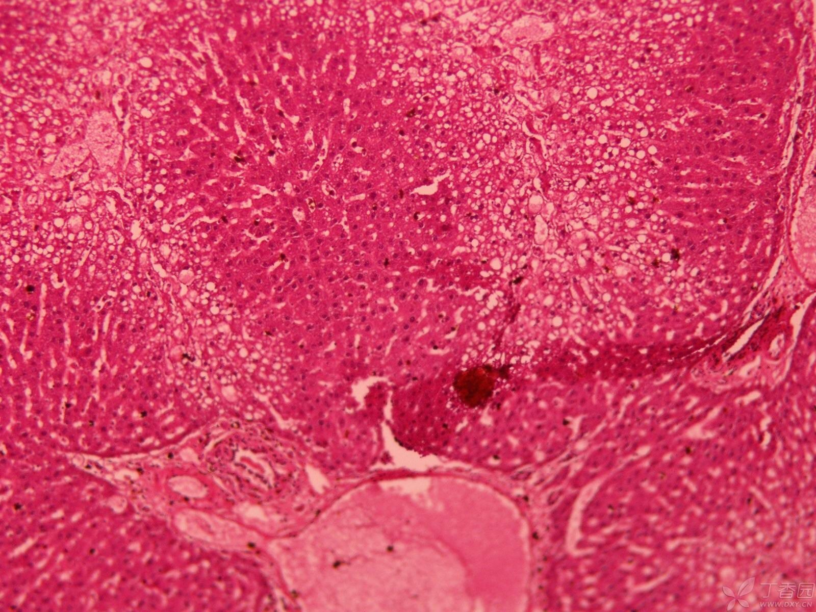 【讨论】大鼠肝纤维化肝脏病理切片,请各位老师帮忙看看