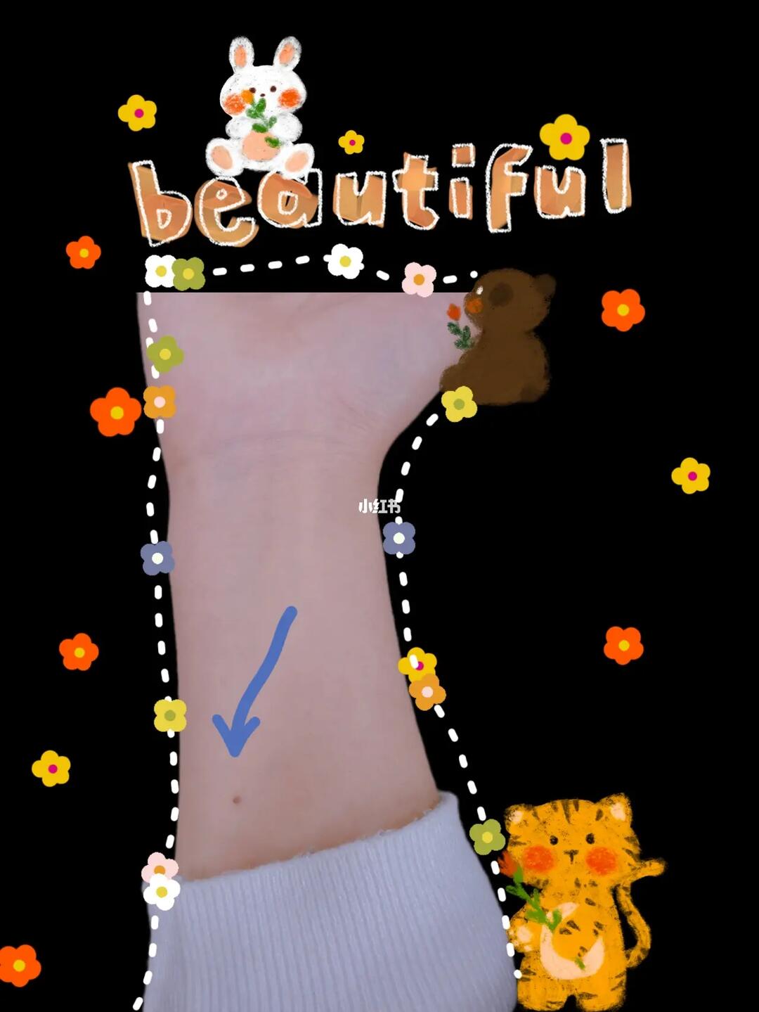 谁知道右手臂内侧有痣,会遇到什么呢