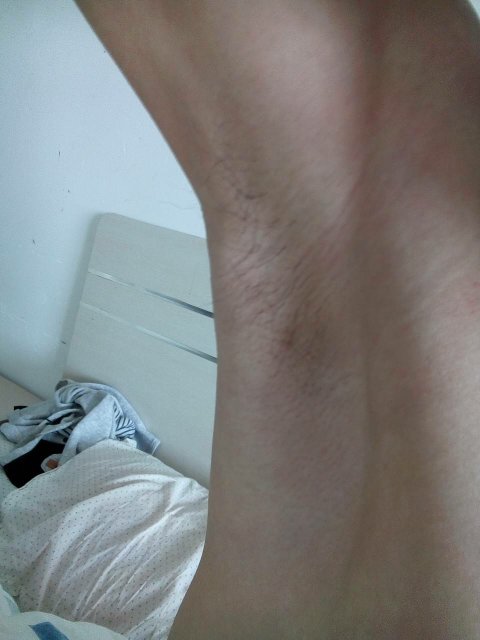 男腋毛长这么些,还能长个吗,你们多大腋毛是长这么些的?