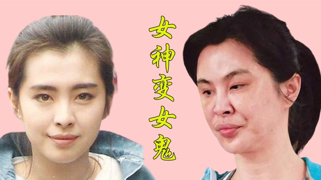 女星整容失败前后对比王祖贤脸部变形判若两人张檬取出假体颜值回归