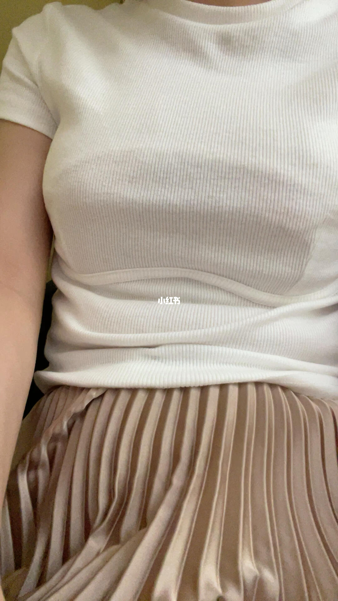 假体胸第17天_隆胸_假体隆胸_美妆_医美整形