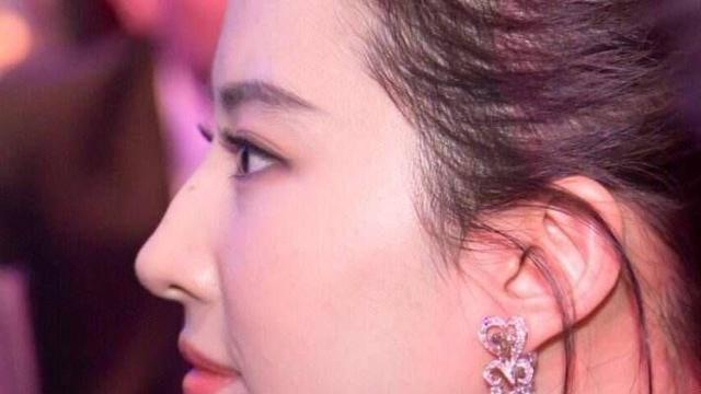 刘亦菲为何没把驼峰鼻做了