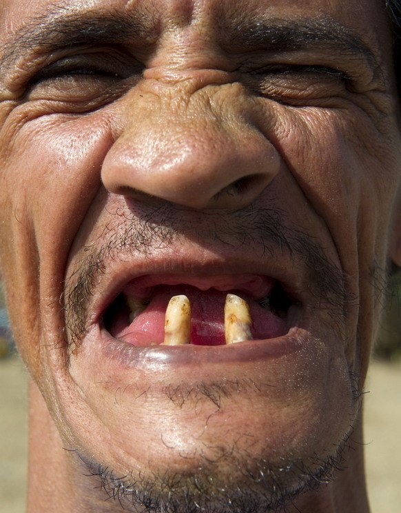 "丑男大赛"(reign of the ugly)哥伦比亚举行,19名选手比拼自己的"丑