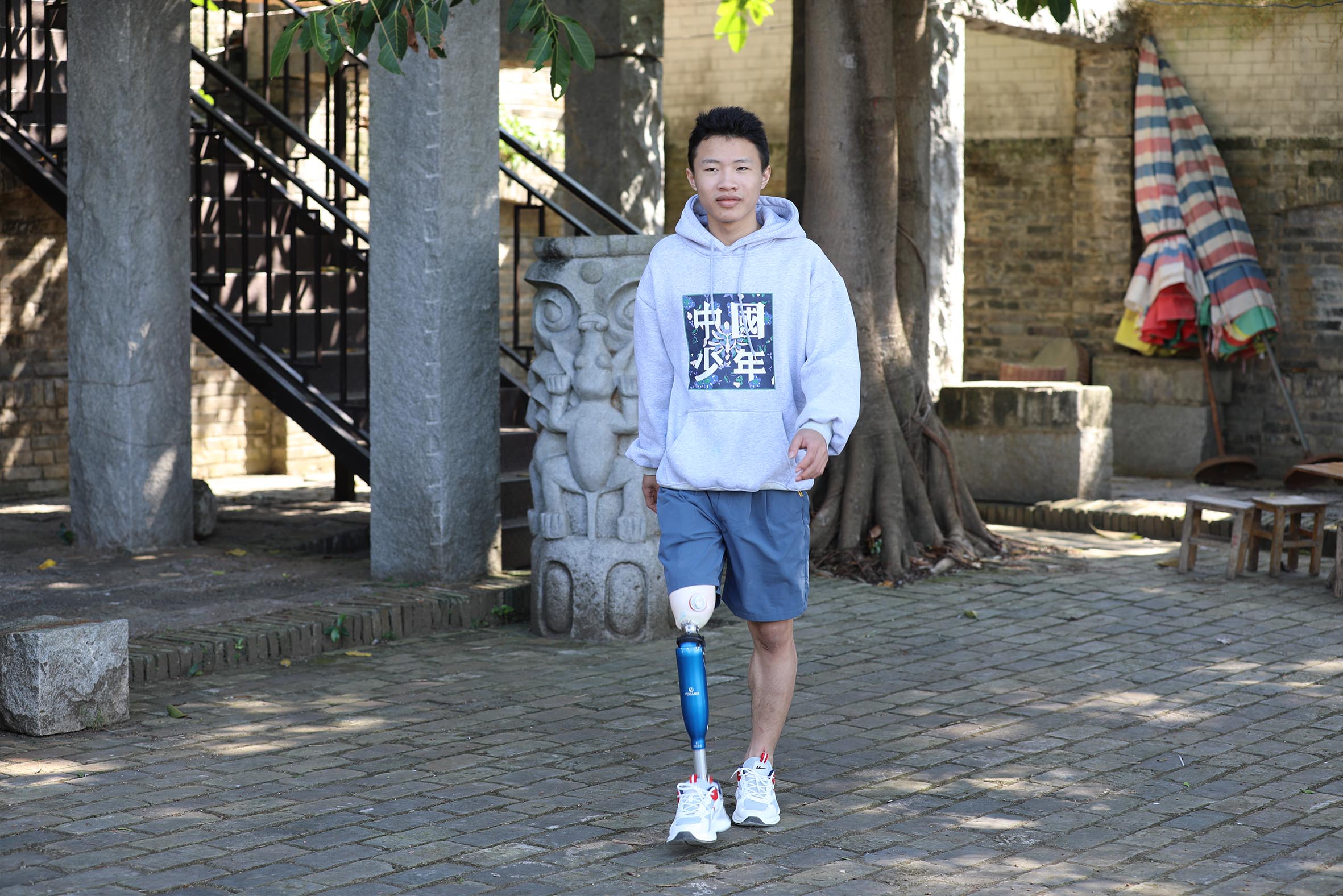 截肢后残肢出现萎缩一般多久定型?_肌肉_假肢_运动