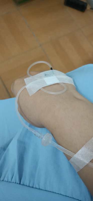 谁有在医院或者卫生院打点滴的视频发一下花呗打赏