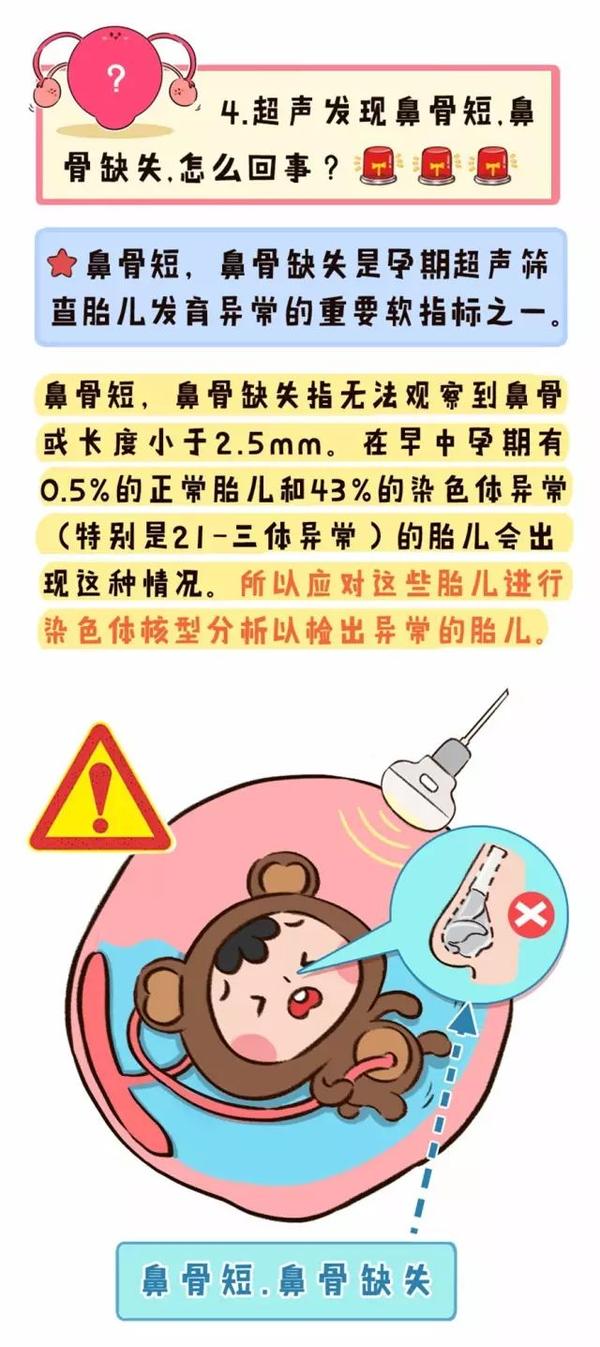 孕期检查重头戏:大排畸!晦涩数据专业解读!
