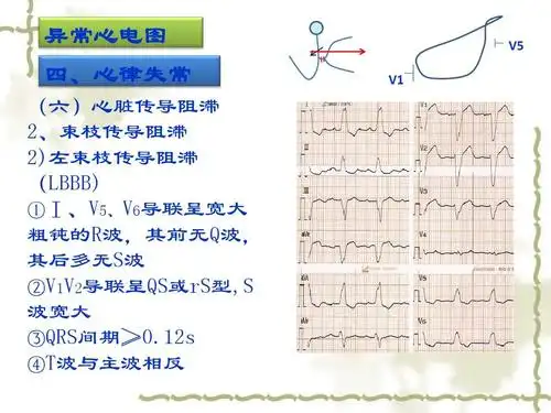 实验诊断学:异常心电图检查ppt