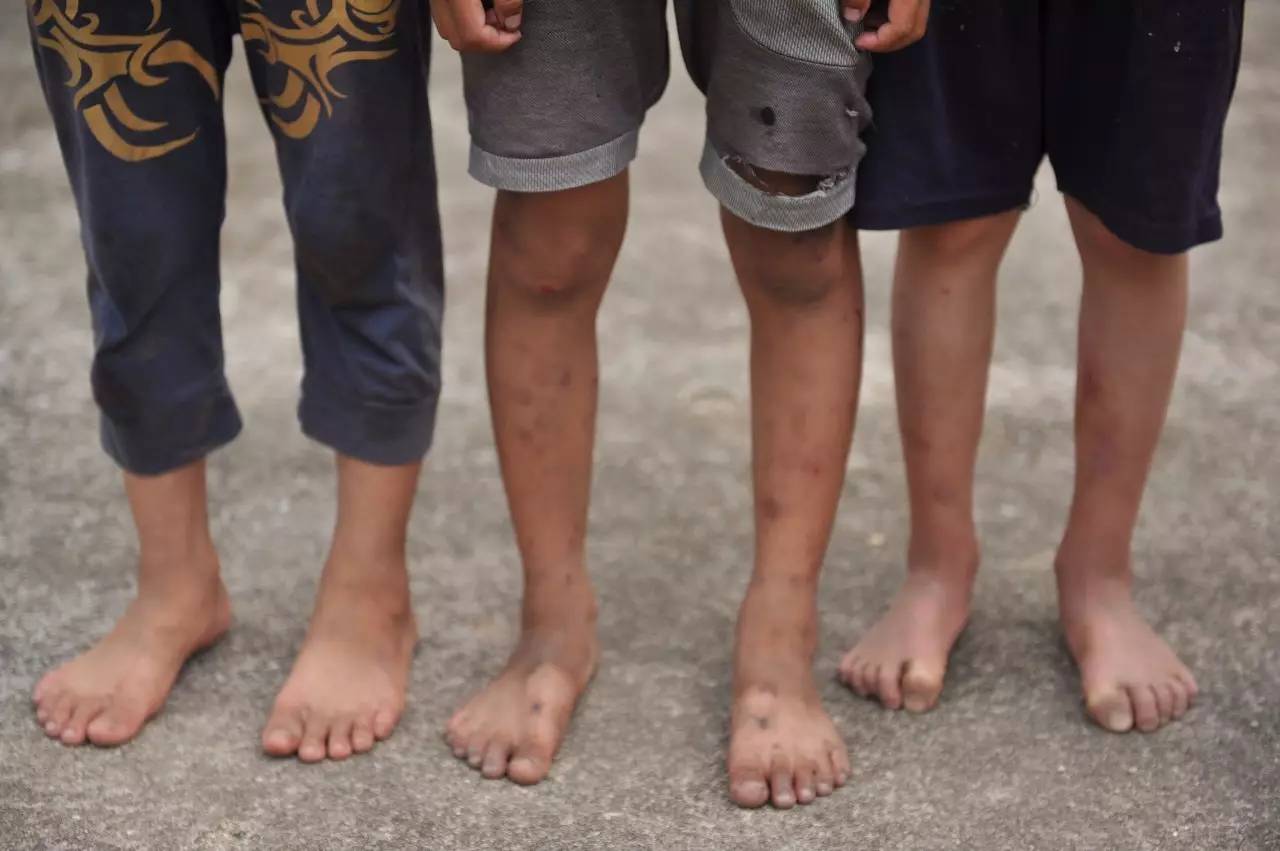 他们,光着脚上学.