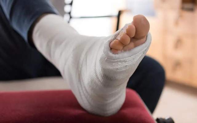 石膏固定术后护理要点有哪些?