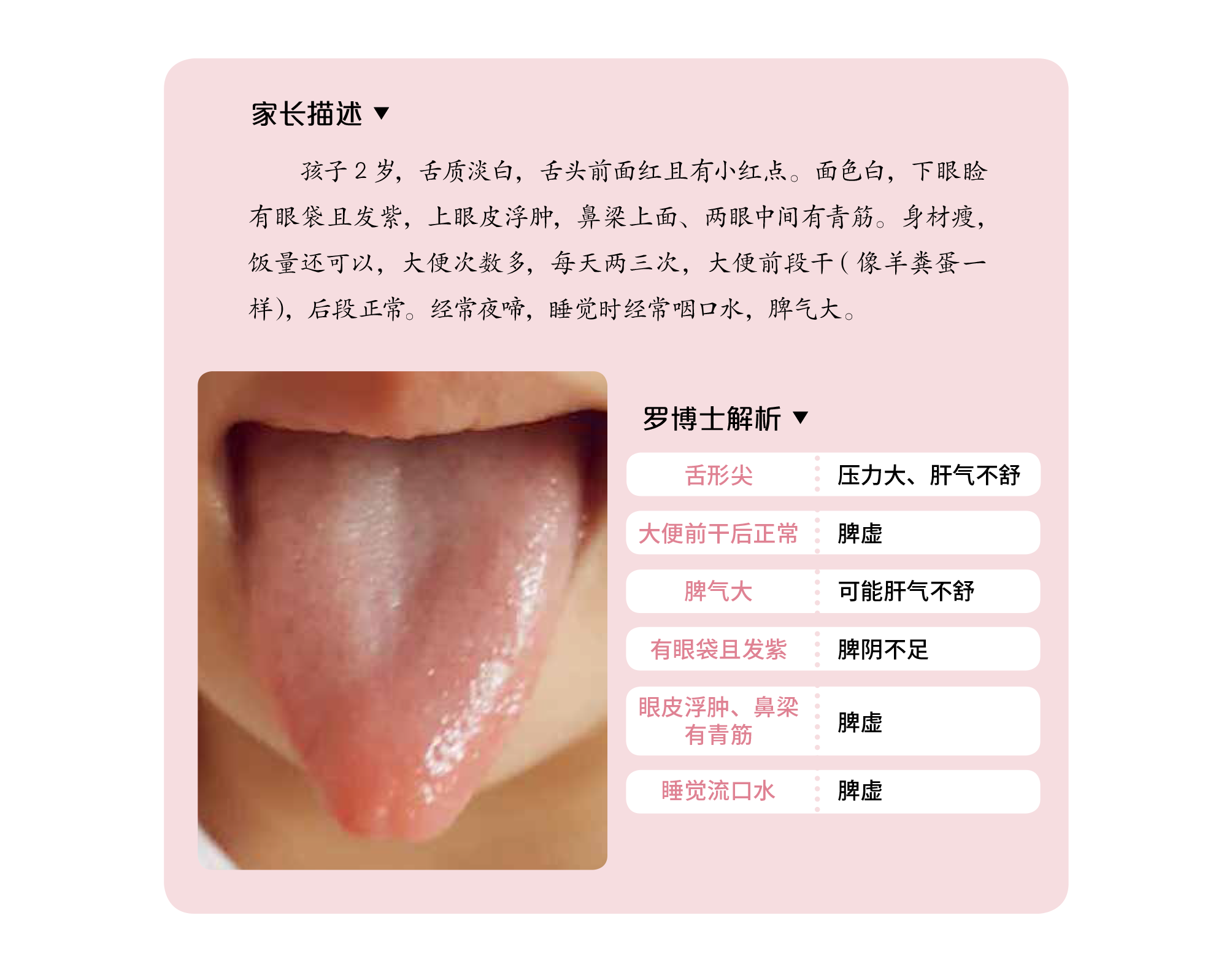 试听180秒38.肝气不舒的孩子,可能脾虚,湿气重