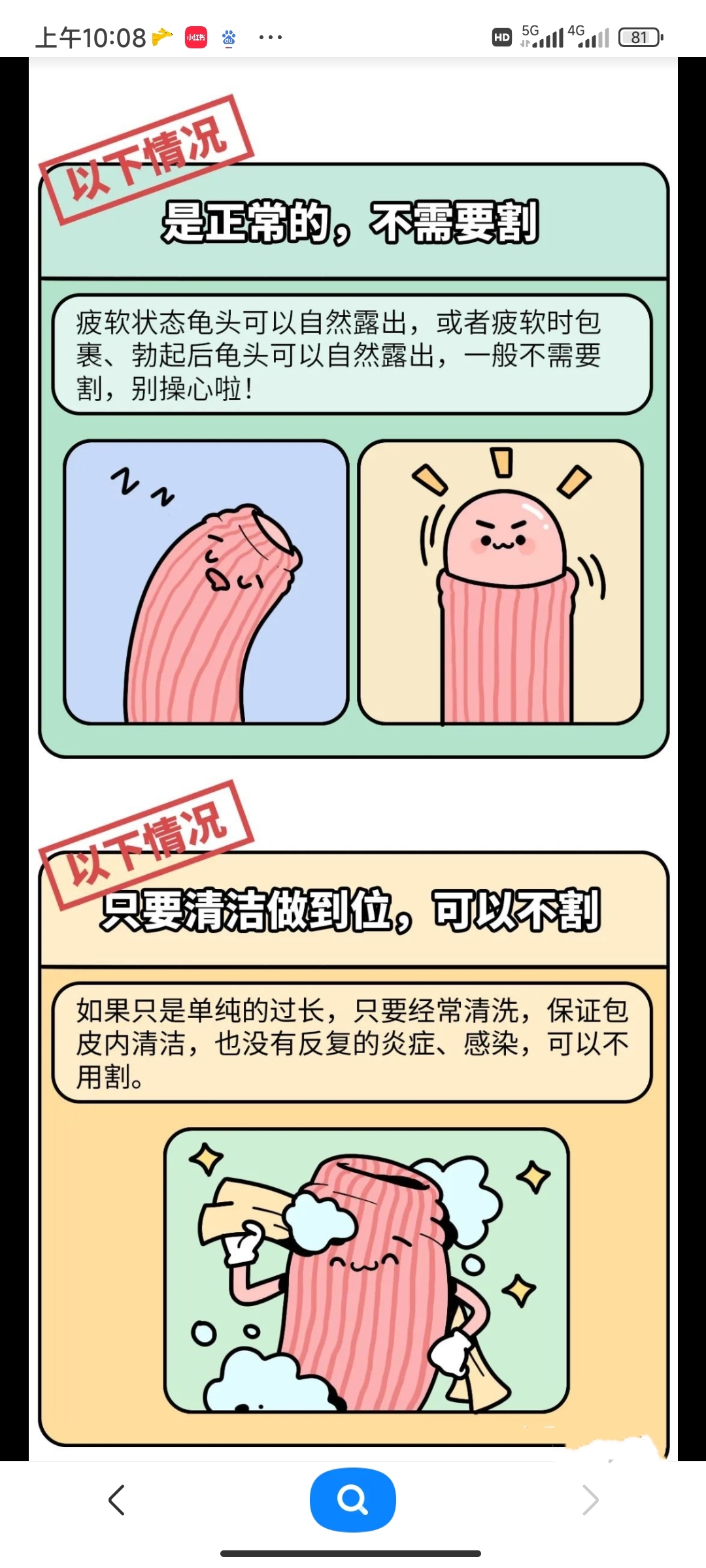 包皮垢引起的炎症用什么药  沈阳男科医院科普  包皮垢引起的龟头炎