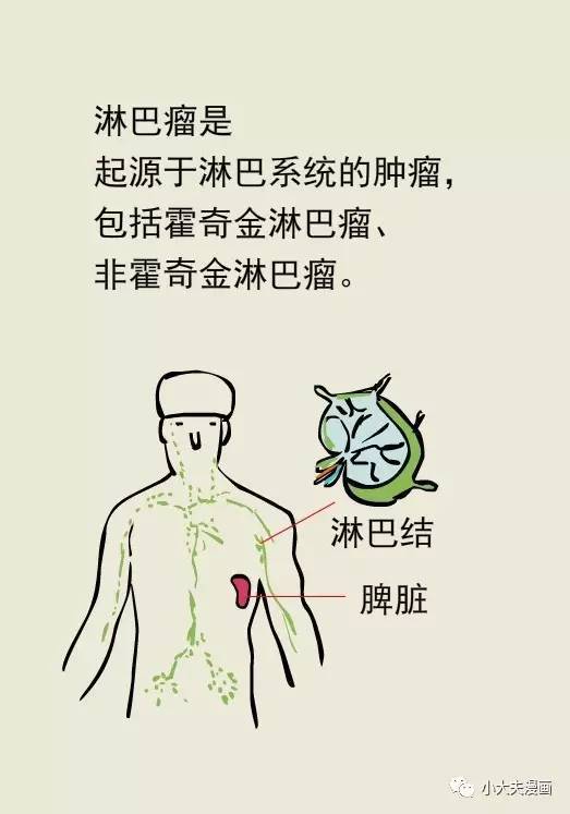 脖子上长肿块就是淋巴瘤吗?