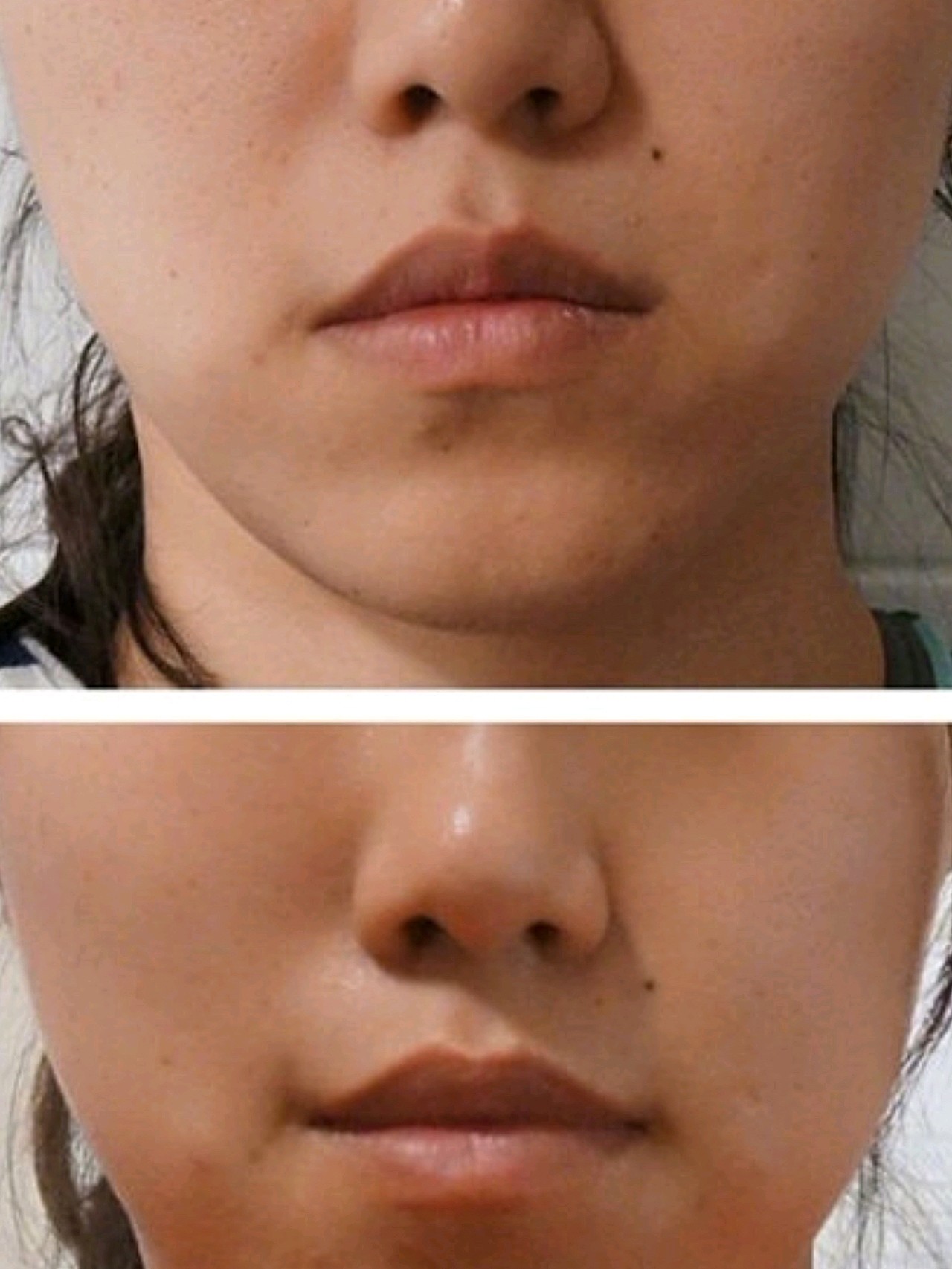 嘴角下垂看起来严肃或沮丧,容易散发出"生人勿近"的_圈子-新氧美容