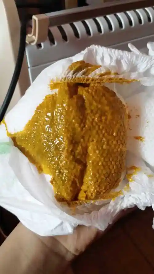 宝宝便便这颜色对吗?