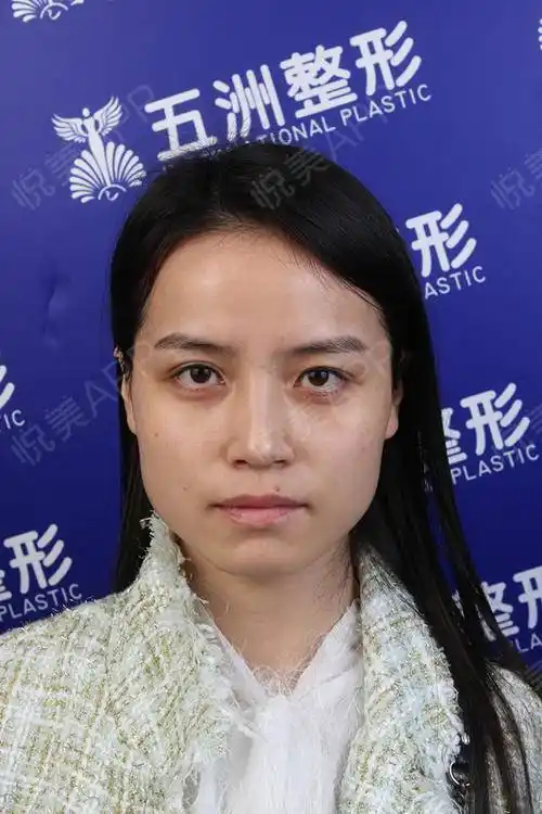 普通人最大的悲哀,大概就是打眼一看没什么太大的问题,五官都还过得去