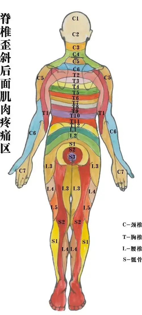 有疼痛就可找到相对应的歪斜脊椎