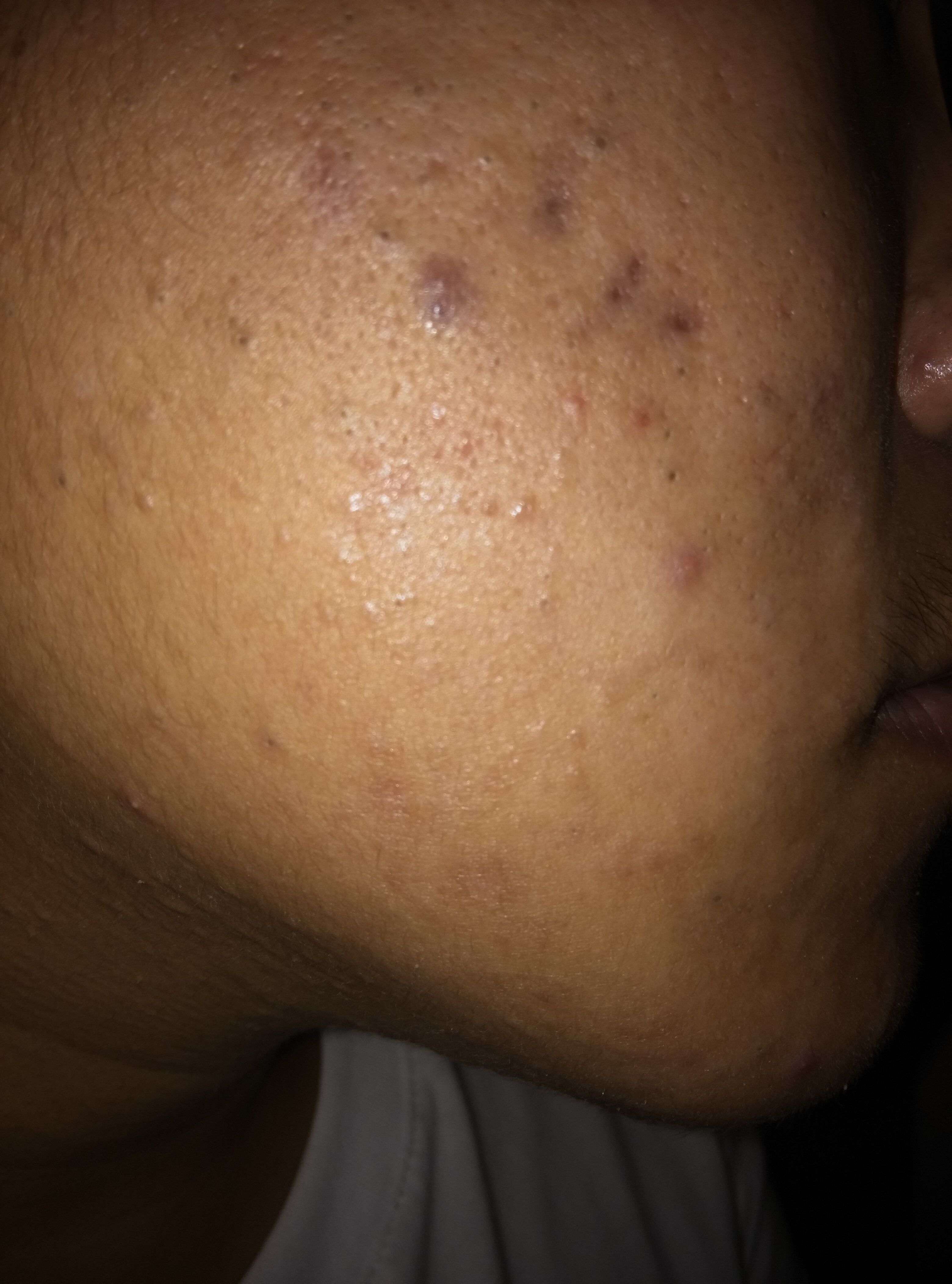 皮肤一直都很差怎么办