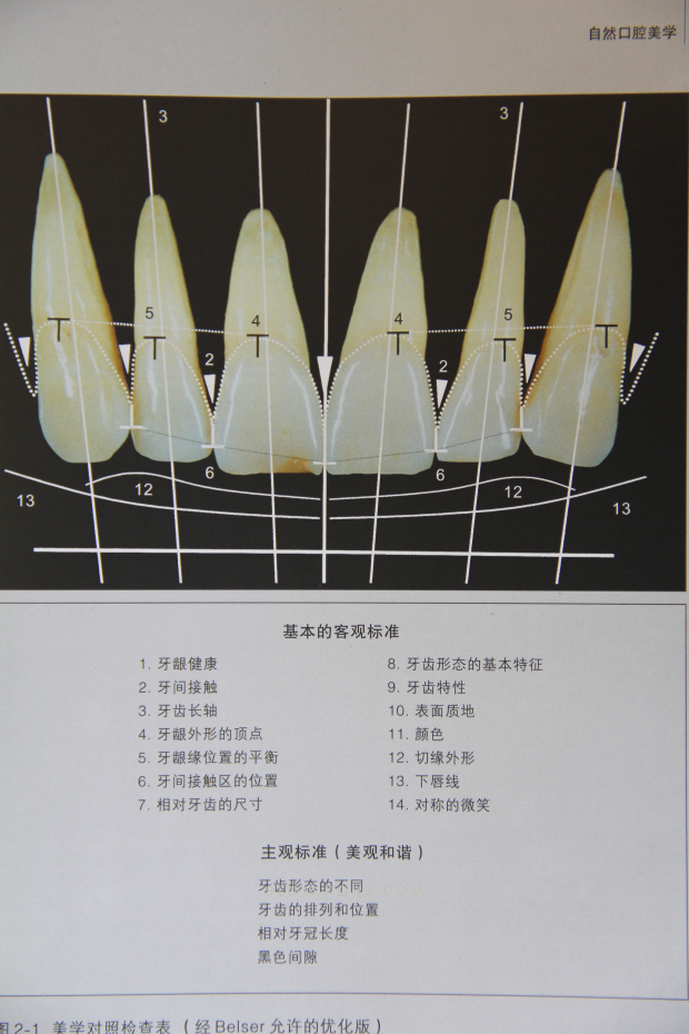 前牙瓷粘结仿生性修复摘要及病例分析王汉禹