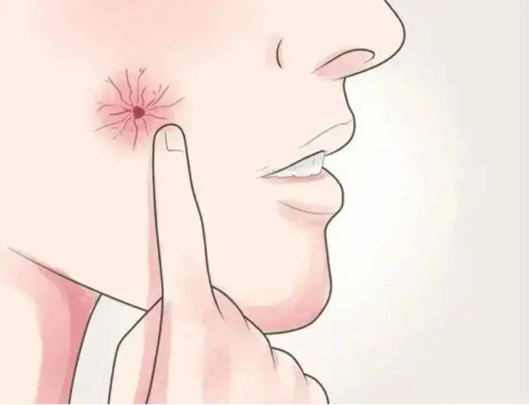 皮肤上的6个癌症预警信号!每个人都要注意_肿瘤_检查_部位