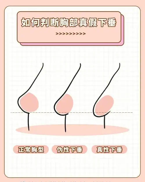 我真的会谢还有姐妹不知道真假下垂胸型吗