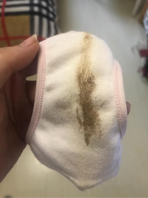 有褐色分泌物有图慎入