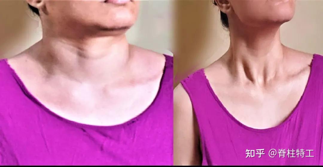 人体锁骨就像一个拉长的"s",连接肩部和胸腔,是颈与胸的分界.