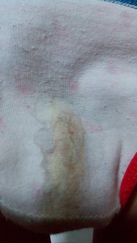 我11,女,小学,我的白带正常不?