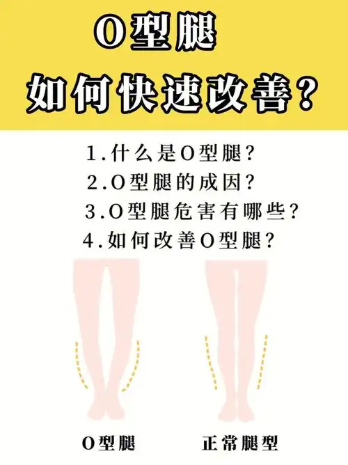 轻松改善o型腿必学的矫正动作