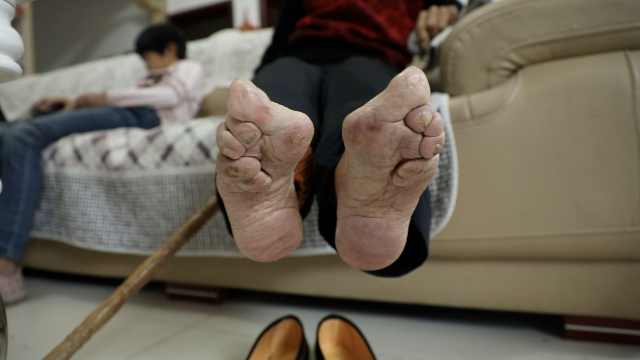 百岁老人|她子孙近百人,能穿绣花针