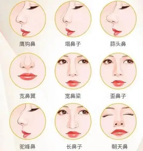 各种鼻子类型图片介绍